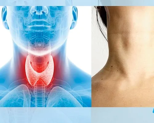 Homeopathy Doctor in Mumbai